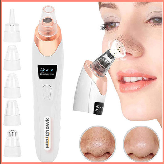 Derma Suction – Rechargeable Blackhead Remover