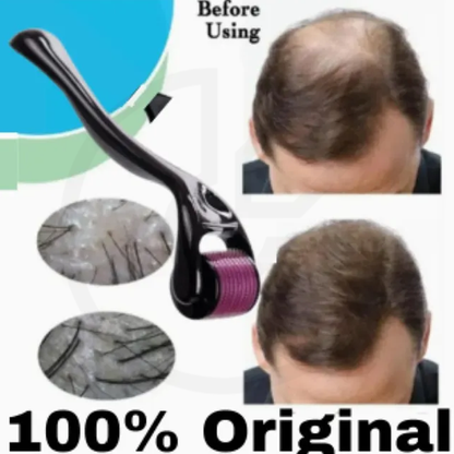 Derma roller